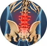 Artritis